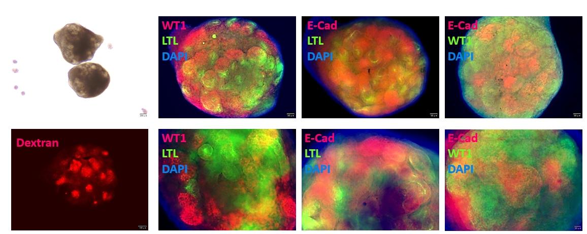 Under bright field, transparent tubular structures in the spheres of 3D renal organoids can be observed, which have the basic characteristics of podocytes, distal tubules, and proximal tubules, and possess endocytic function.
