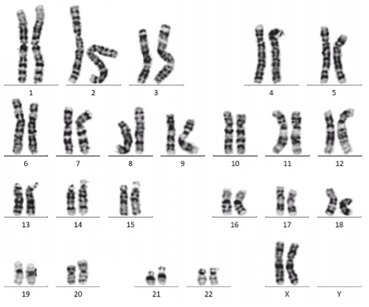 3.G-banding Karyotype Analysis: a image taken under high magnification of a standard light microscope!
