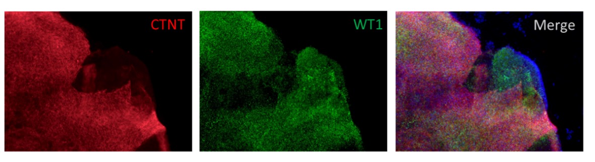 Cardiac Organoids Express cTNT and WT1