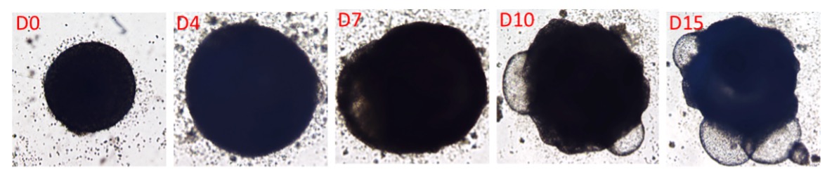 Morphology of Cardiac Organoid Differentiation
